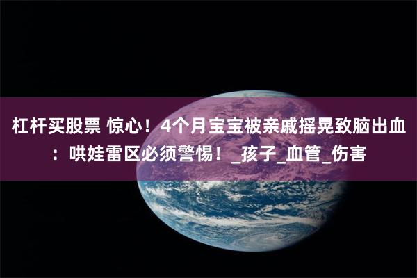 杠杆买股票 惊心！4个月宝宝被亲戚摇晃致脑出血：哄娃雷区必须警惕！_孩子_血管_伤害